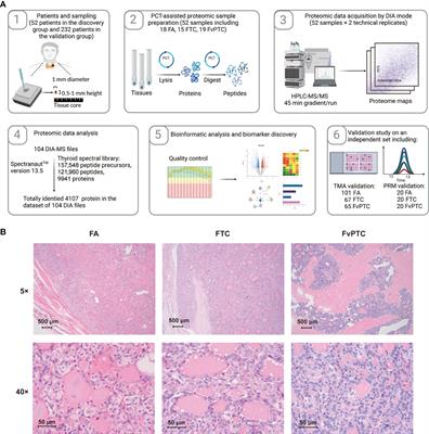 Proteotypic Differences of Follicular-Patterned Thyroid Neoplasms